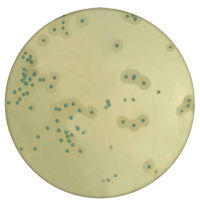 Хромогенные питательные среды для выявления Listeria monocytogenes