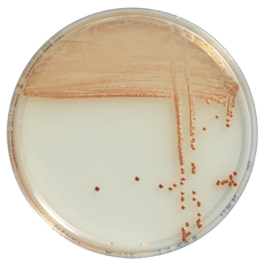 Характер роста бактерий. Кампилобактерии на питательных средах. Listeria monocytogenes BIOMERIEUX. Кампилобактер рост колоний. Кампилобактер на агаре.